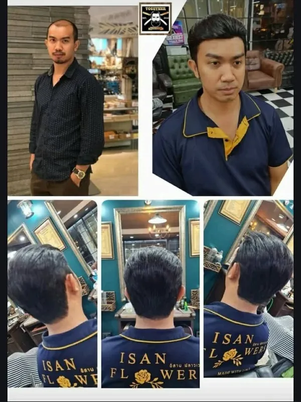 Before and after a hair system fitting